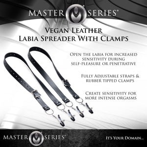 Spread Xl Labia Spreader Straps